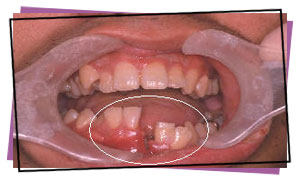 Broken jaw photo 1