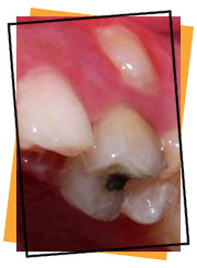 Loose Tooth photo