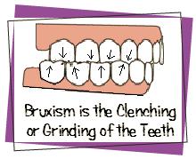 Bruxism is a common dental problem