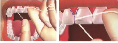 Flossing Instructions
