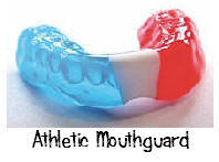 Athletic Mouthguard for prevention